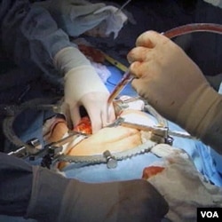 Seorang pasien yang gagal ginjal sedang menjalani transplantasi di sebuah rumah sakit di AS.