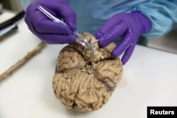Seorang peneliti memeriksa otak manusia yang mengidap Multiple Sclerosis dan Parkinson di Imperial College London, Inggris 3 Juni 2016. (Foto: Reuters)